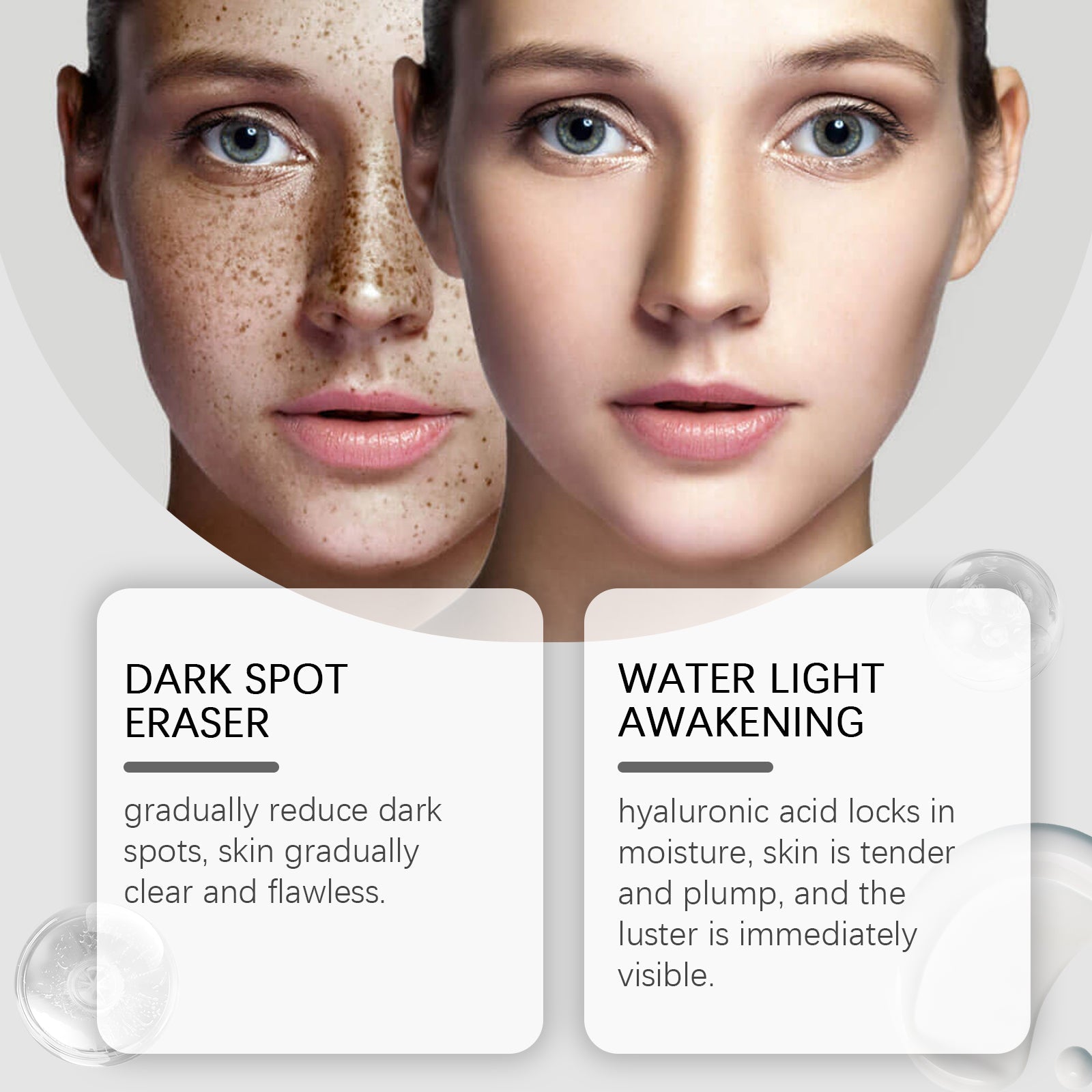Dark Spot Repair Lotion Moisturizes And Hydrates Facial Skin With Skin Care Spot Repair Lotion