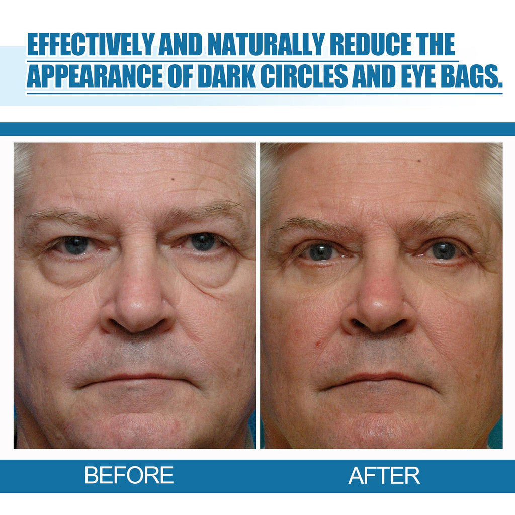 Men's Eye Serum Reduces Fine Lines, Bags, Dark Circles, Moisturizes, Firming, Brightening And Anti-Aging Eye Area