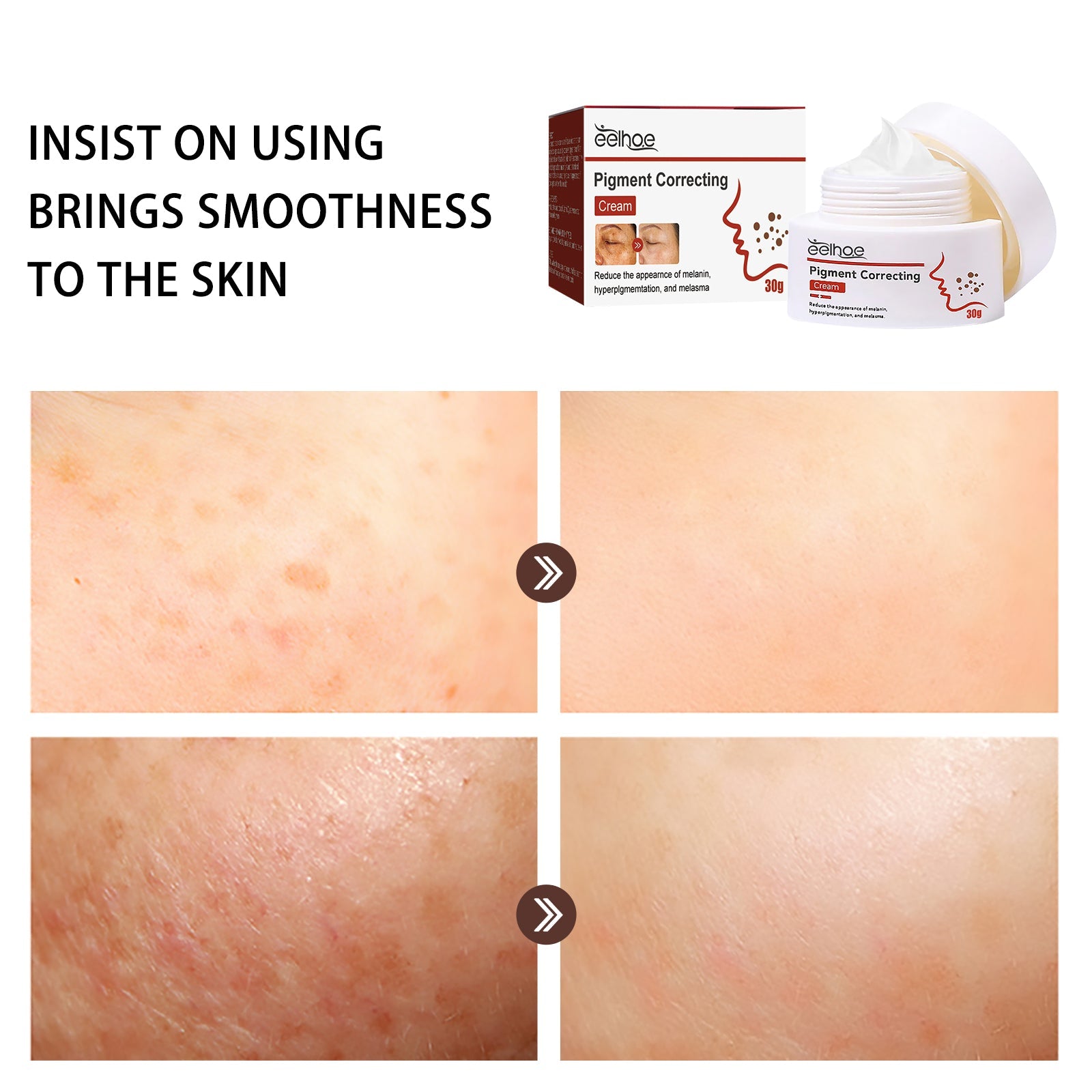 Pigment Repair Cream, Moisturizing And Lightening Freckles Dark Spots Spots Melasma Melanin Beauty Cream