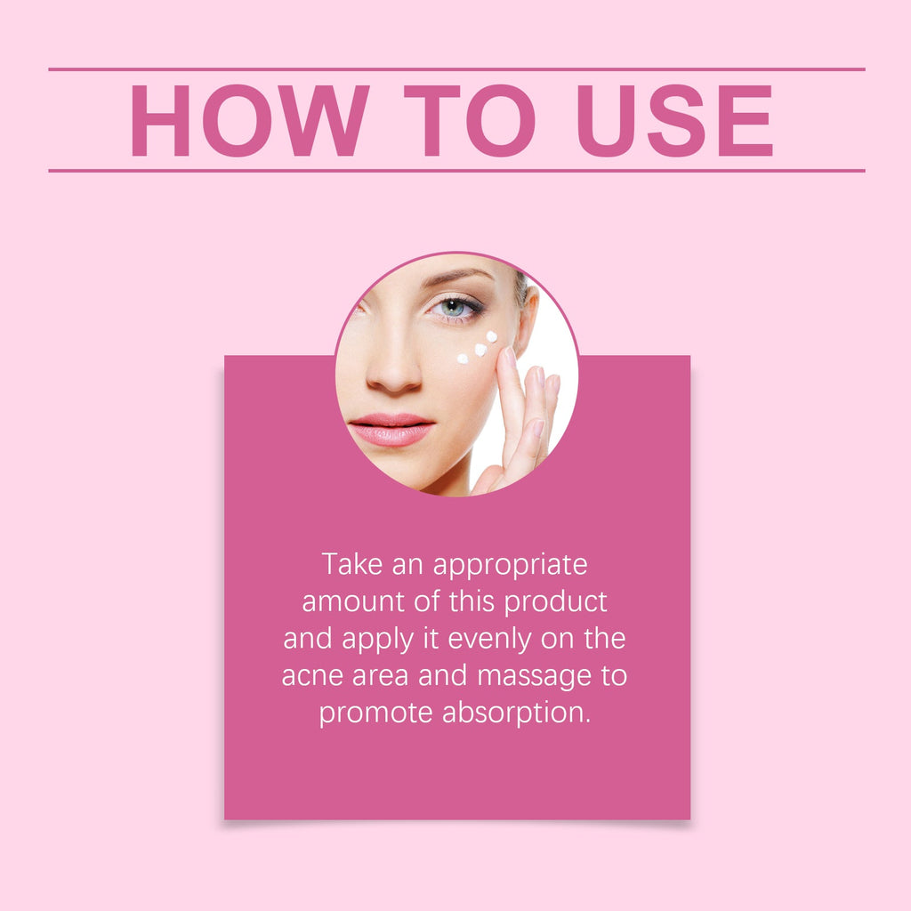 Facial Acne Cream, Repair Facial Acne, Close The Mouth To Nourish Skin Tender And Smooth Skin Care Cream