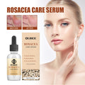 Erythematous Repair Essence, Repair Skin Lighten Facial Erythematous Moisturizing Essential Oil