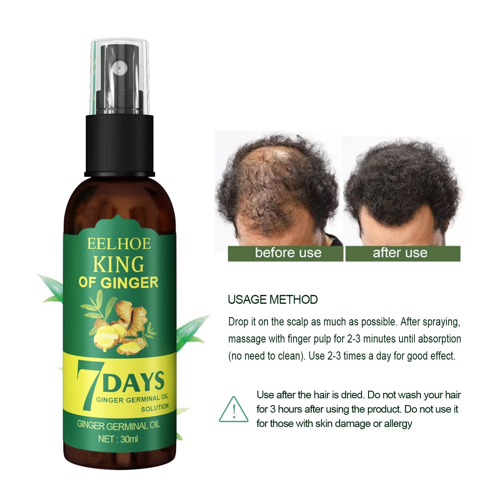 EEL Ginger Hair Spray, Strengthens Hair, Massages Scalp And Restores Hair