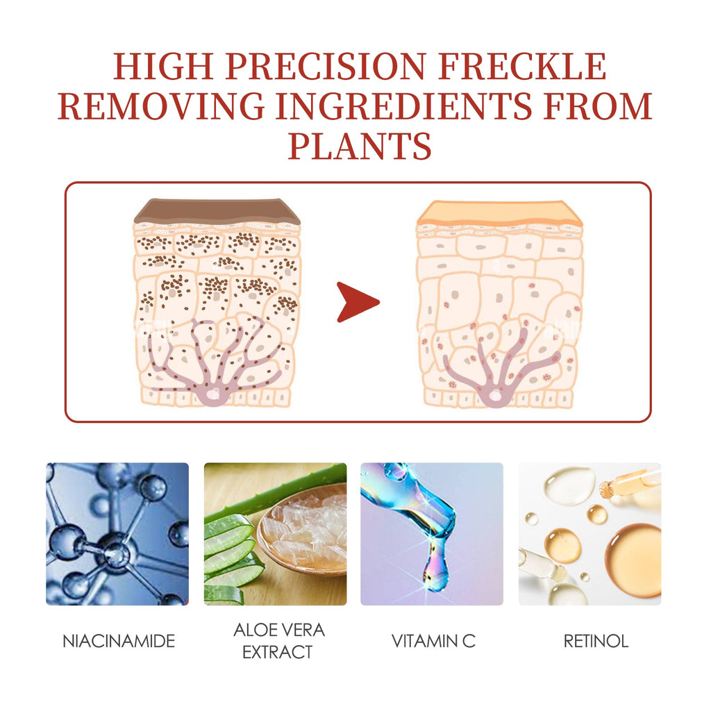 Pigment Repair Cream, Moisturizing And Lightening Freckles Dark Spots Spots Melasma Melanin Beauty Cream