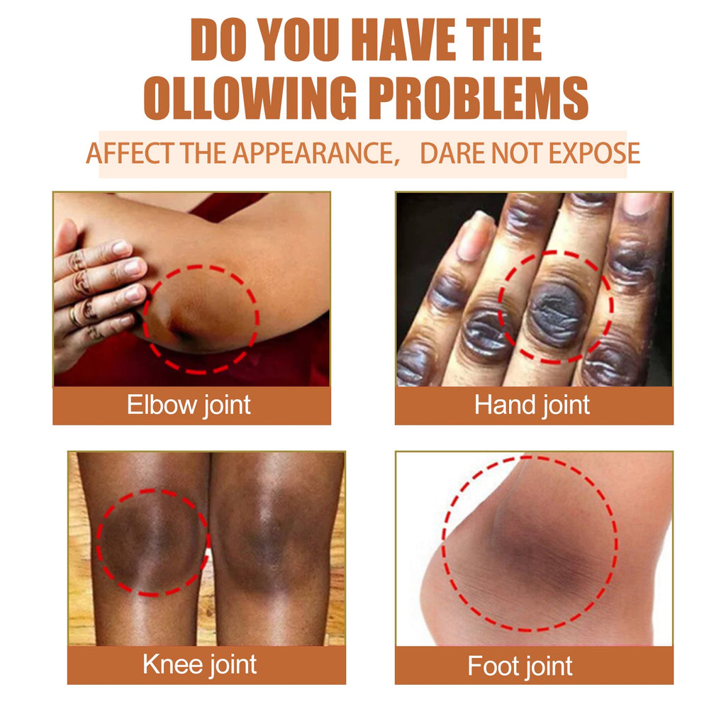 Papaya Seed Skin Care Oil Lightening Dark Spots, Bending Joints, Elbows, Brightening Skin And Moisturizing Oil