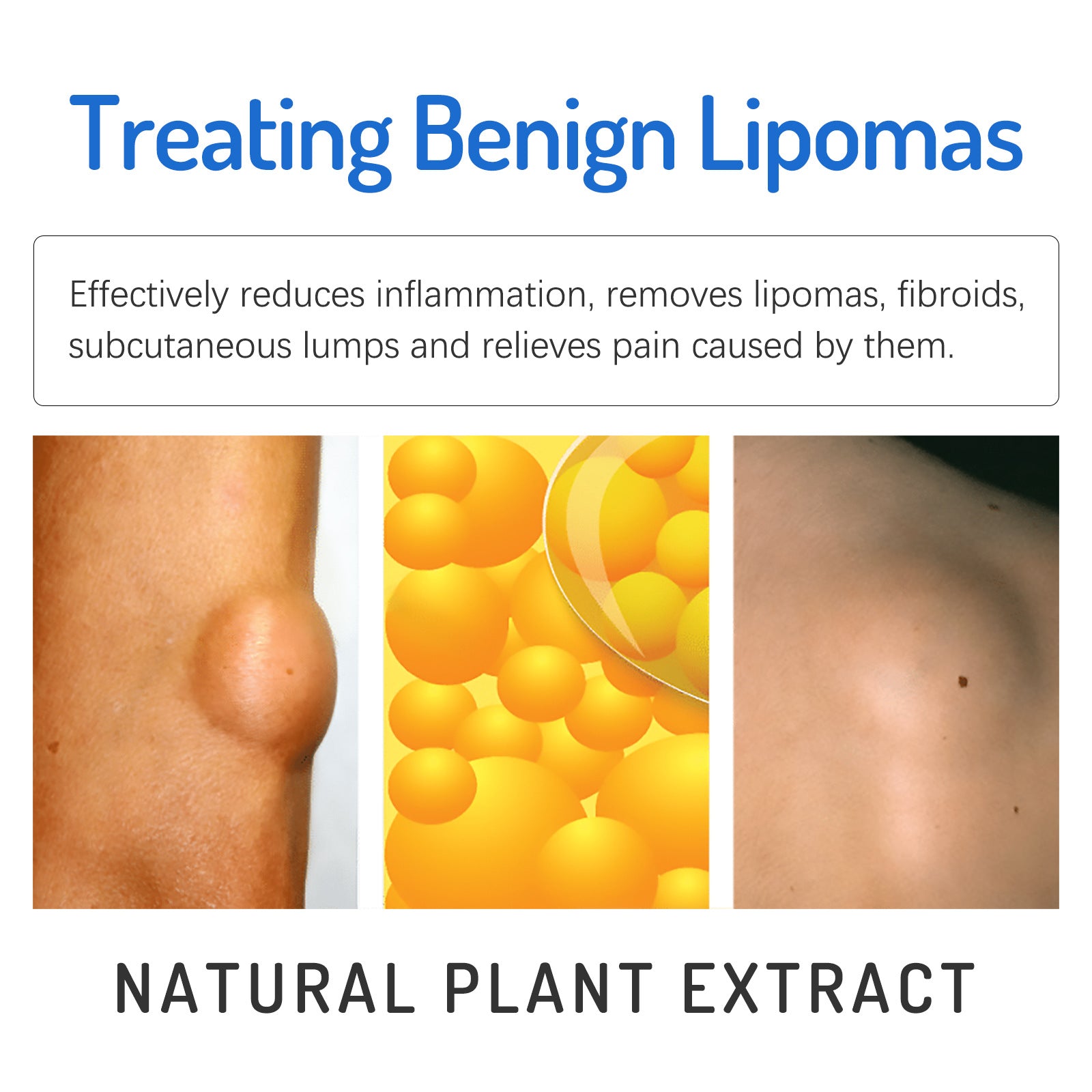 Body Care Cream Gentle Daily Nourishing Relief Of Physical Discomfort Leg Repair Cream